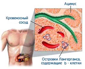 http://www.endocrinolog.ru/images/cms/data/diabet_07.jpg