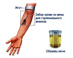 Гормональный анализ крови и мочи